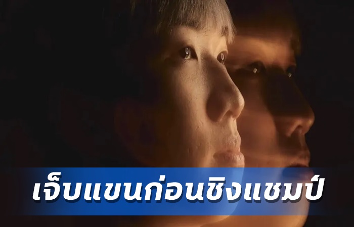 sScary เจ็บแขนไร้ช่วยทีม